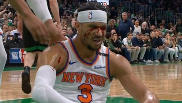 Josh Hart gushes blood from face after elbow by Luke Kornet